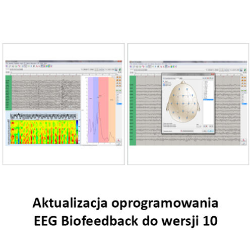 Aktualizacja-oprogramowania-EEG-Biofeedback