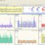 Moduł nr 2 EEG Biofeedback PLUS do zapisu i pełnej analizy sygnału EEG wraz z QEEG